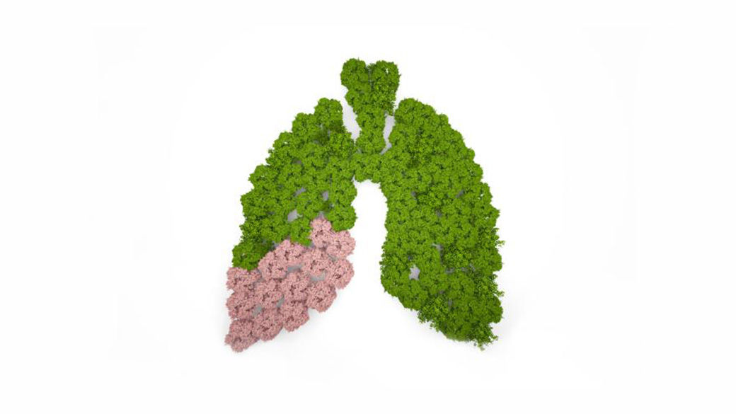 a pair of lungs made up from green trees. The trees are pink in the bottom left lung.