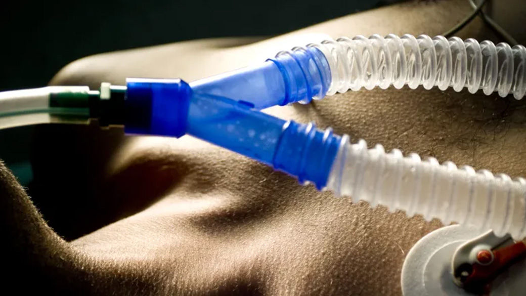 A tube that is delivering low-flow anesthesia on a patient's chest