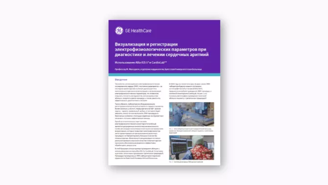 article-imaging-electrophysiology-recordings-allia-igs5-cardiolab-ru-jb00241rc-thumbnail