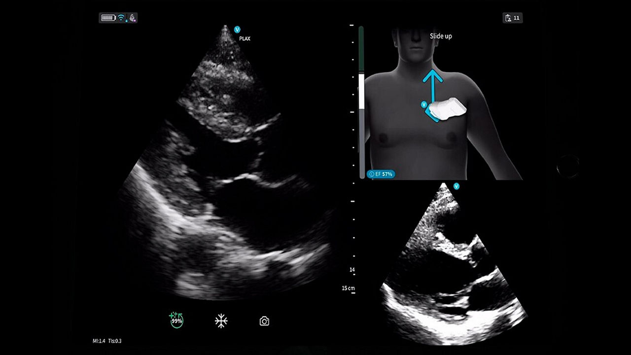 <p>Vscan Air™ SL with Caption AI™</p>
