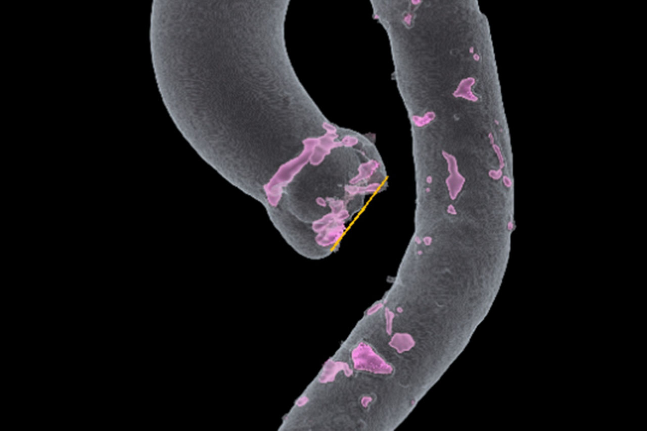 assess-aortic-root-desktop