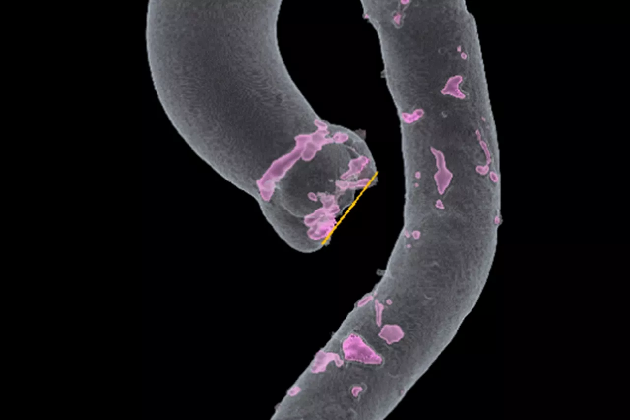 assess-aortic-root-desktop
