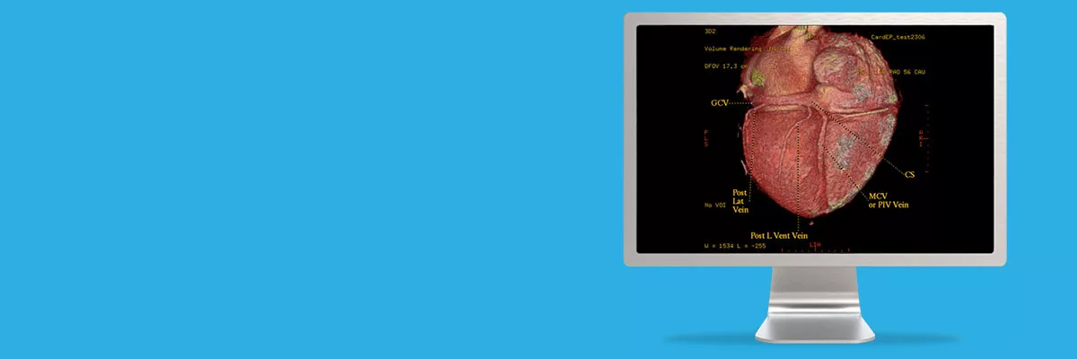 ategories-do-not-clone-advanced-visualization-applications-cardep-aw-cardep-spotlight1.jpg