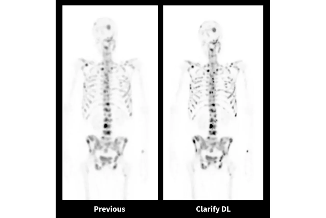aurora-pet-ct-clinical-scan-06-ci-en
