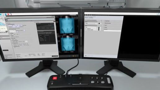 aurora-pet-ct-dual-workstation-st-en