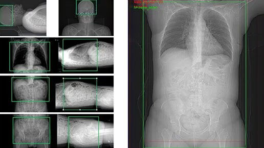 aurora-pet-ct-scout-imaging-ci-en