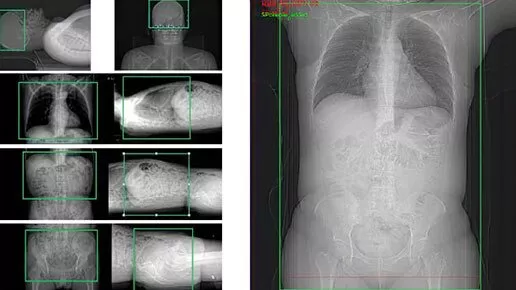 aurora-pet-ct-scout-imaging-ci-en