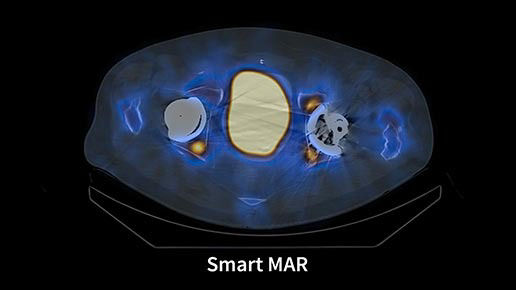 aurora-pet-ct-smart-mar-ci-en