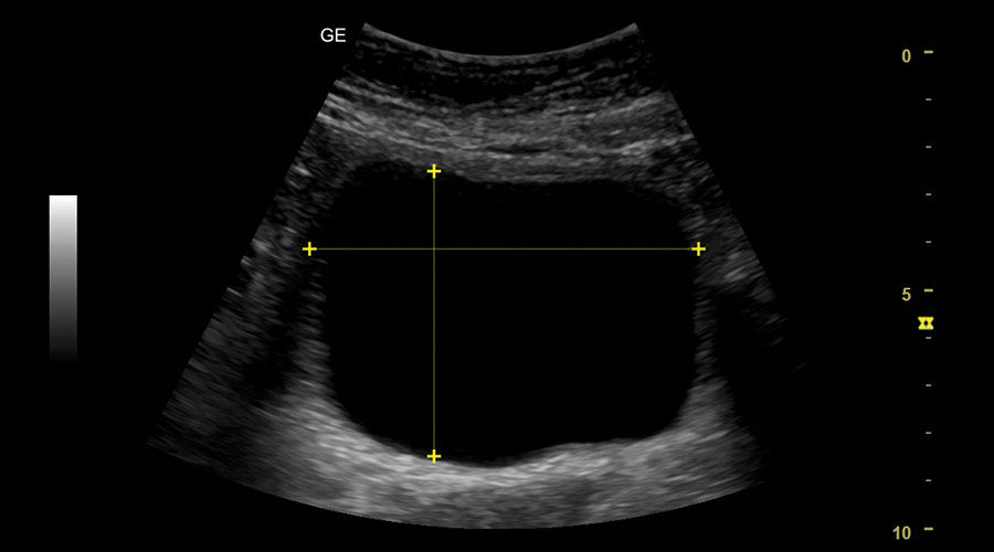 auto-bladder