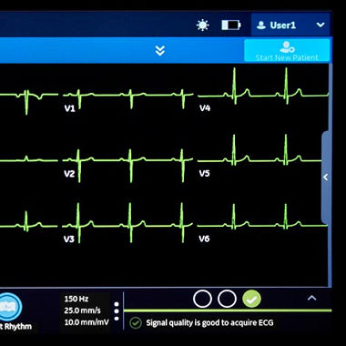 Auto-ECGMAC