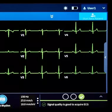 Auto-ECGMAC