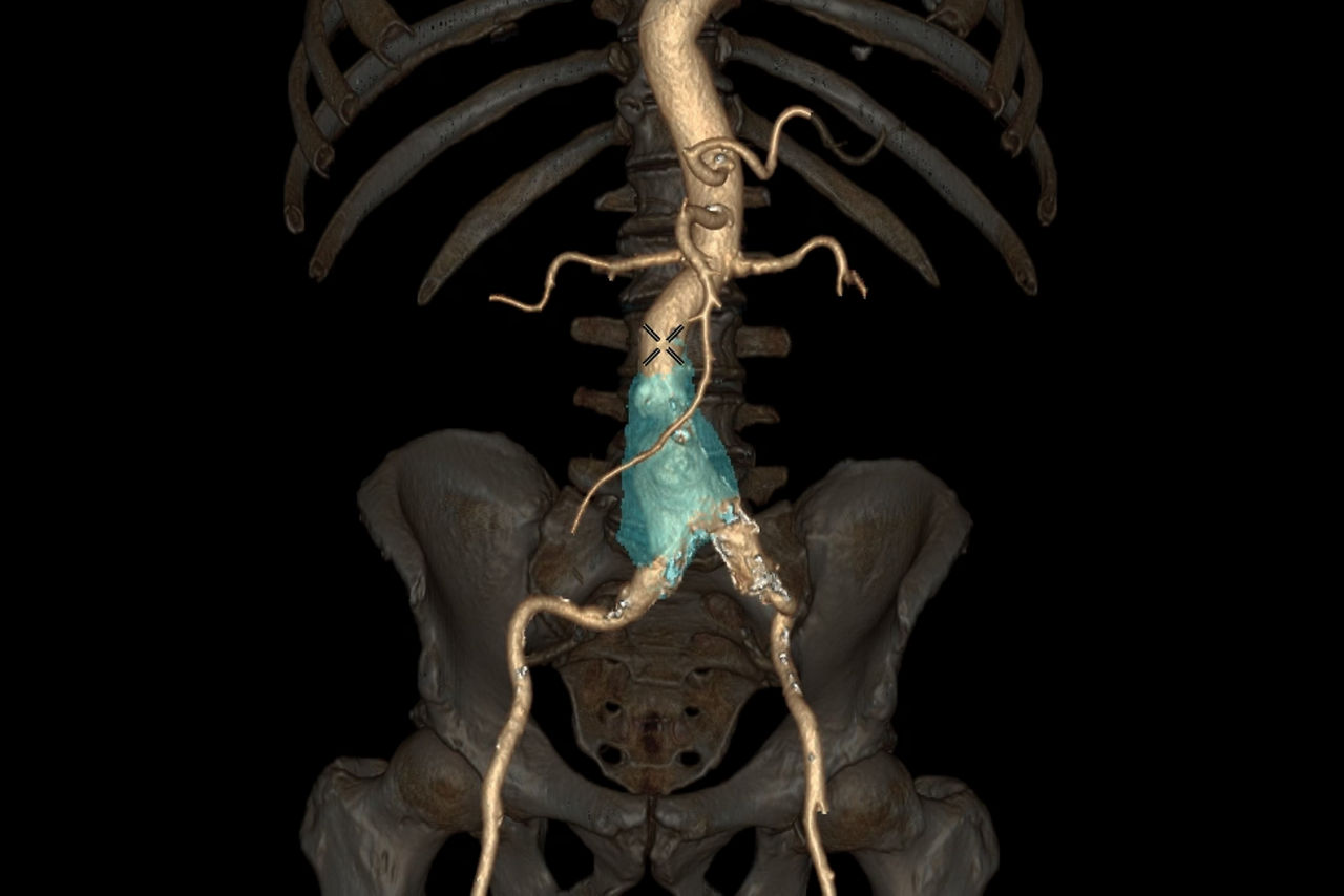 autobone-vesseliq-xpressfeatures-ci-en