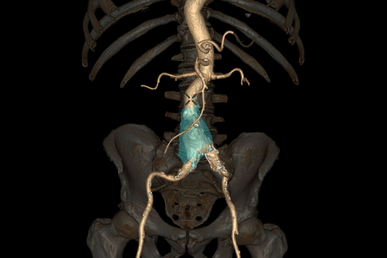 autobone-vesselIQ-xpressfeatures-hero