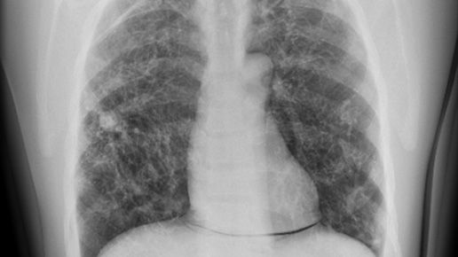 autogrid-software-feature-half-desktop