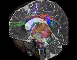 Colored brain scan image.