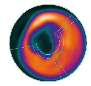 aw-cardiq-physio-overview