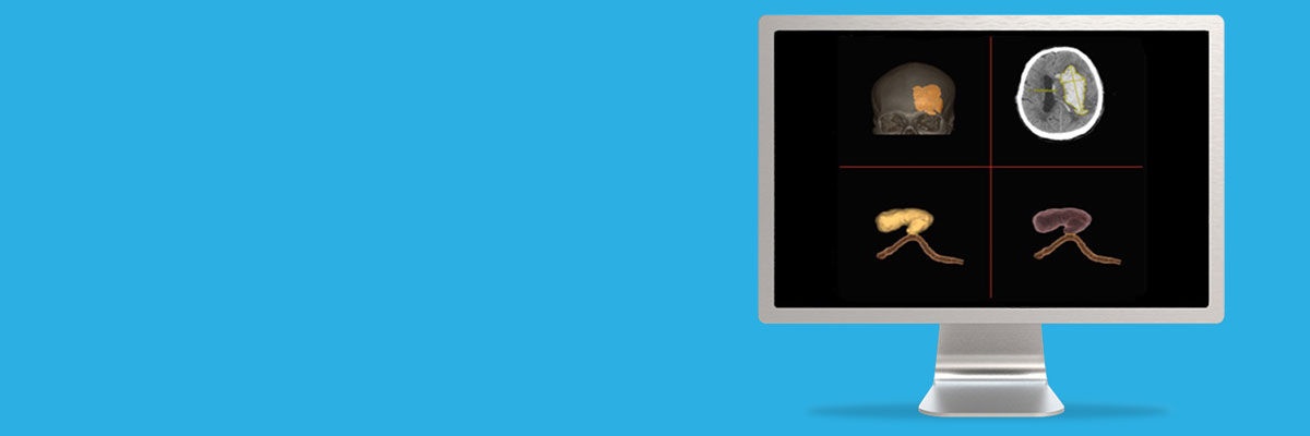 aw-stroke-vcar-spotlight