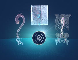 AW-TAVI-Analysis-HERO-270x210