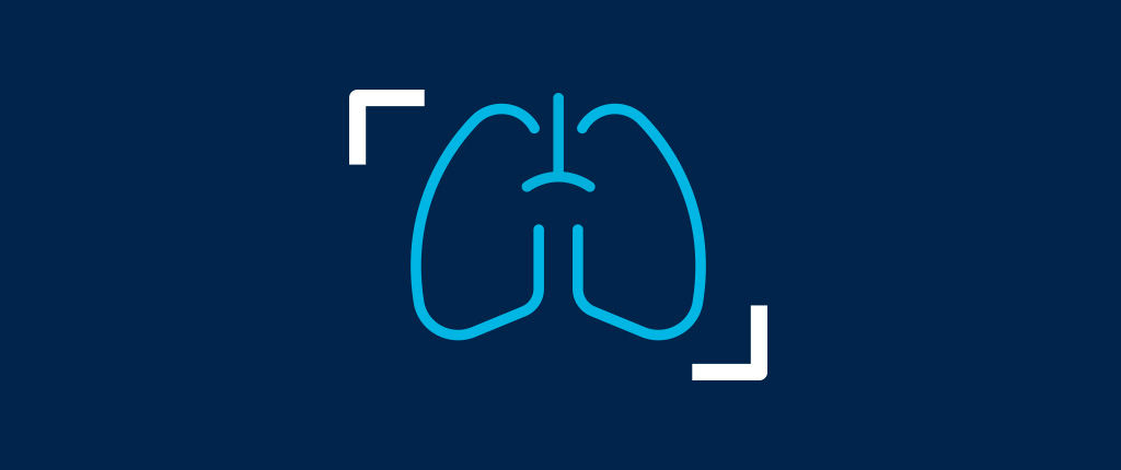 AW-Thoracic-VCAR-dynamic-GlobalBurden