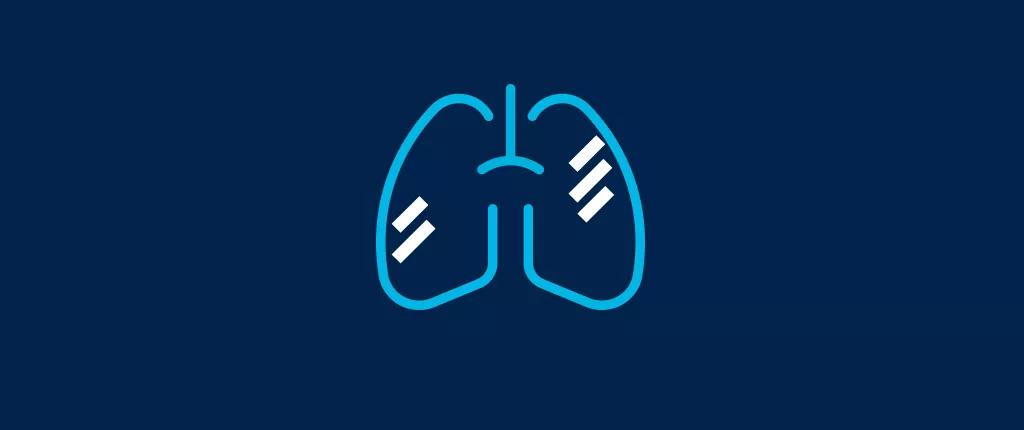 AW-Thoracic-VCAR-dynamic-LungDensityAnalysis