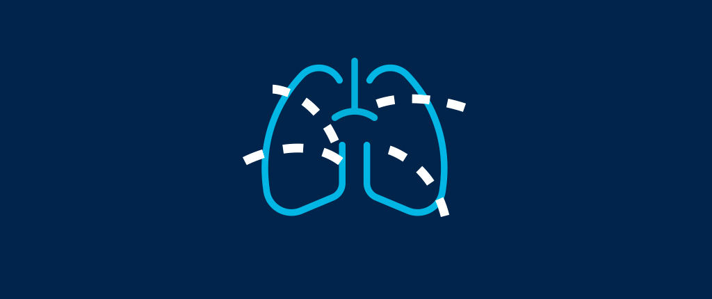AW-Thoracic-VCAR-dynamic-QuantitativeInformation