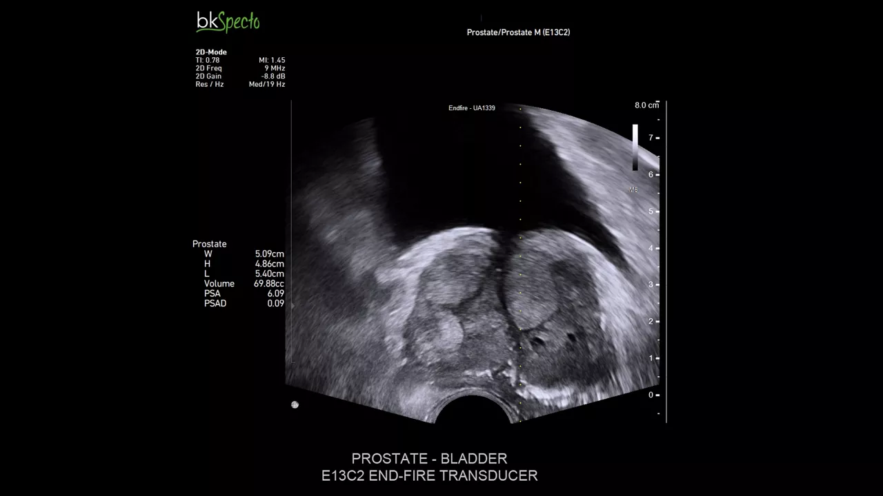 bkactive-ultrasound-system-sticky-hero-ba-1-en