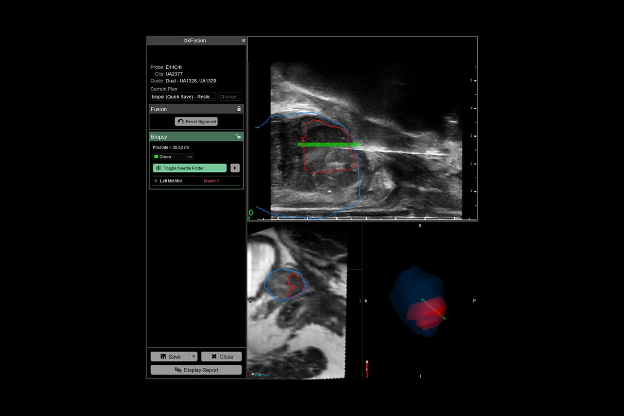 bkfusion-sticky-effortless-imaging-ci-en