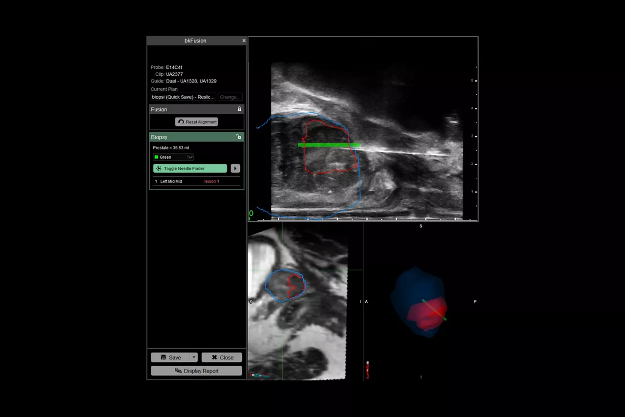 bkfusion-sticky-effortless-imaging-ci-en