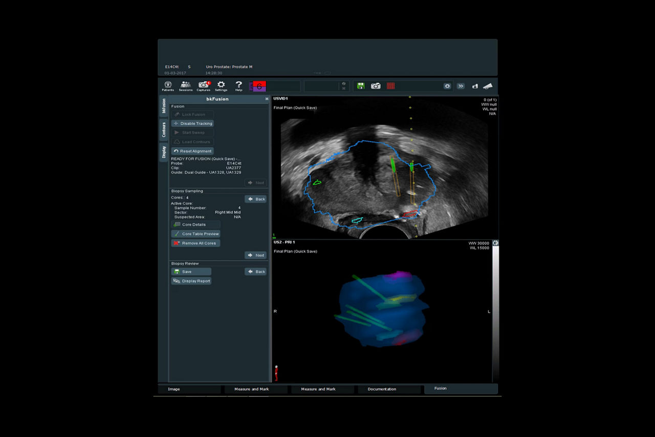 bkfusion-sticky-predictive-fusion-ci-en