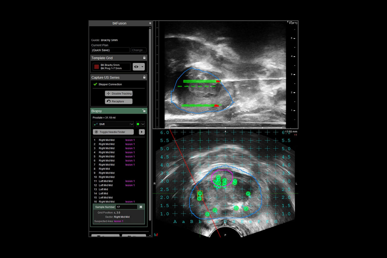 bkfusion-sticky-realiable-results-ci-en