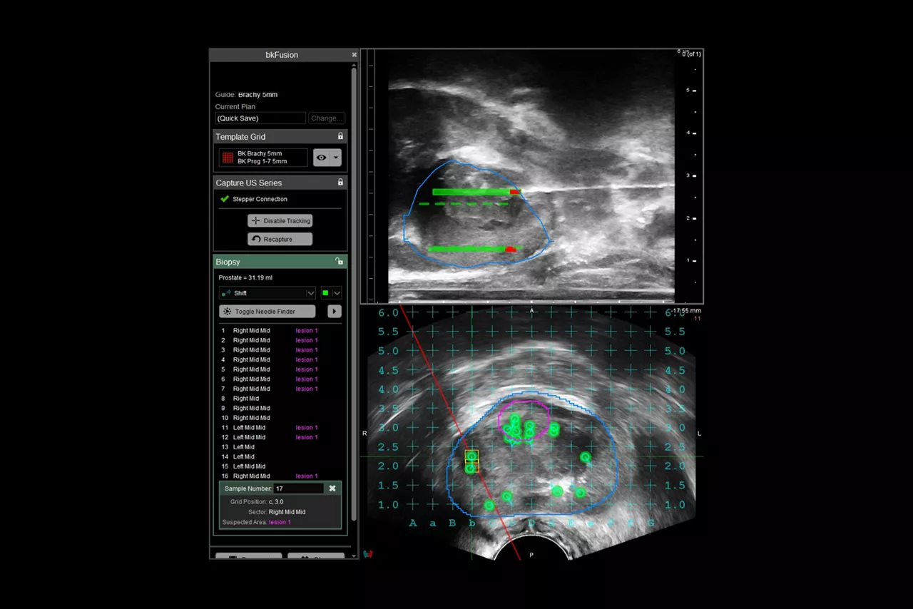 bkfusion-sticky-realiable-results-ci-en