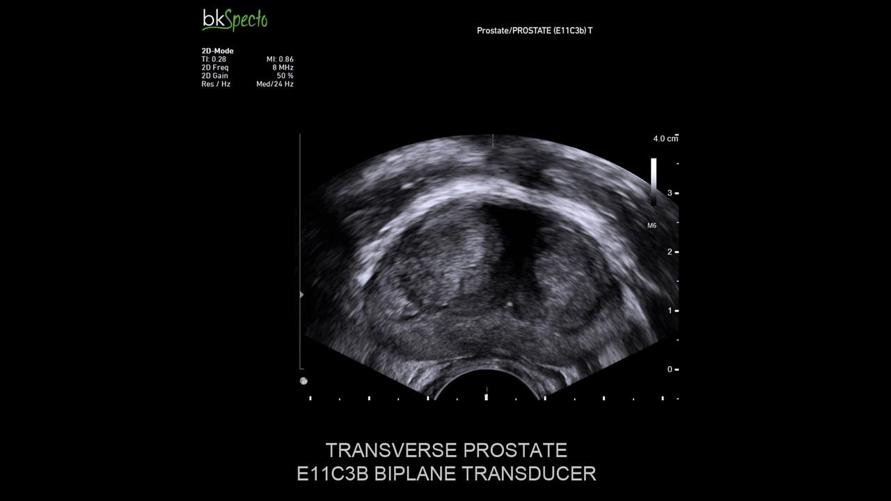 bkspecto-ultrasound-image-carousel-3-ci-en