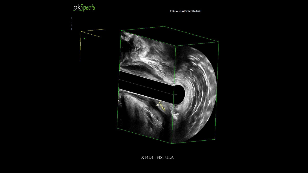 bkspecto-ultrasound-image-carousel-5-ci-en