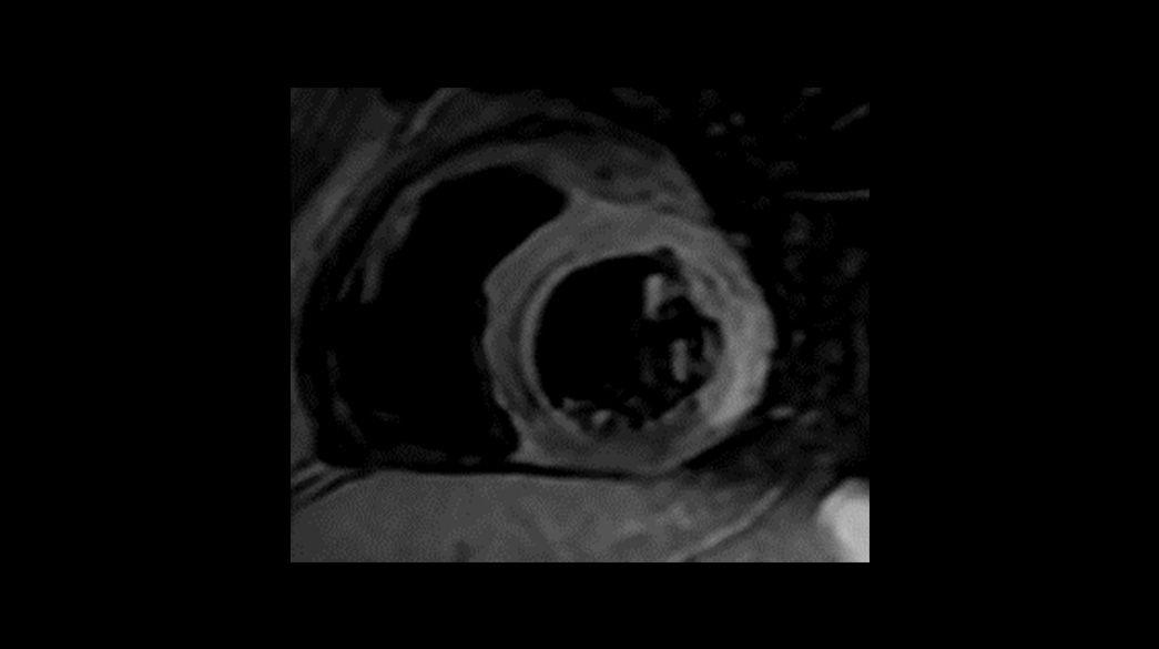 Black-Blood-SSFSE1040-x-585