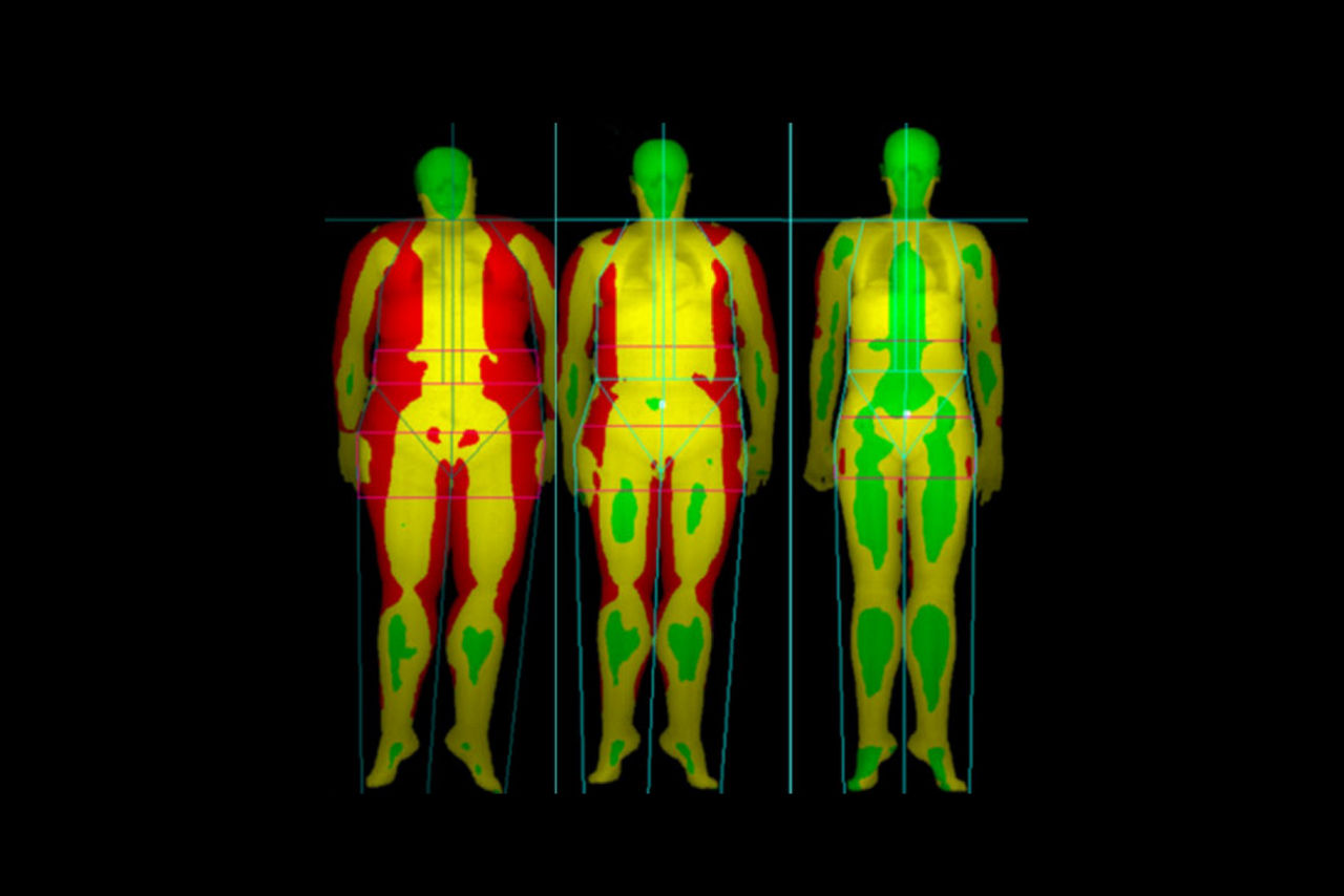 body-composition