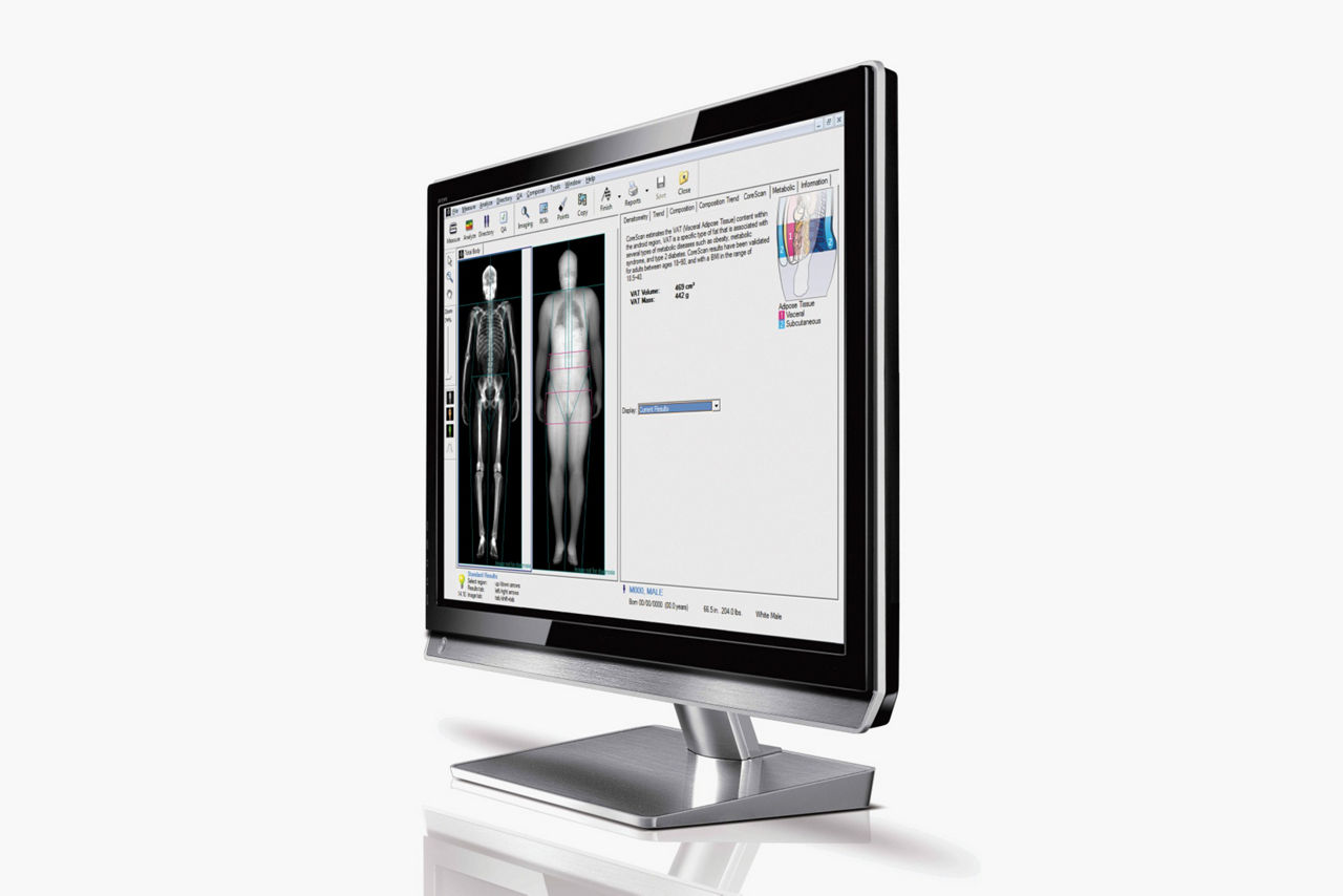 body-composition-for-obesity