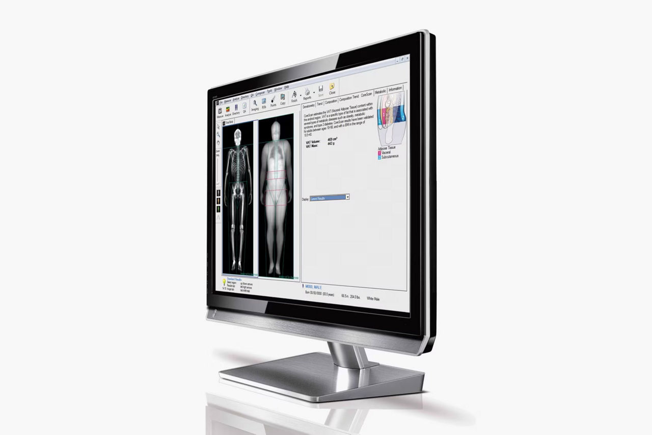body-composition-for-obesity-st-en