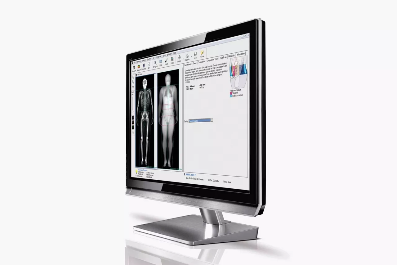body-composition-for-obesity-st-en