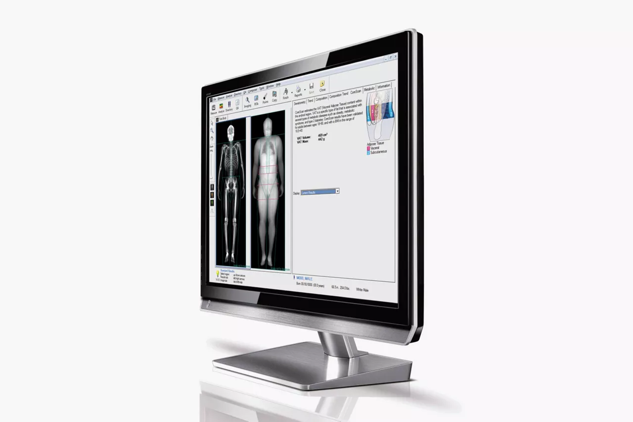 body-composition-for-obesity