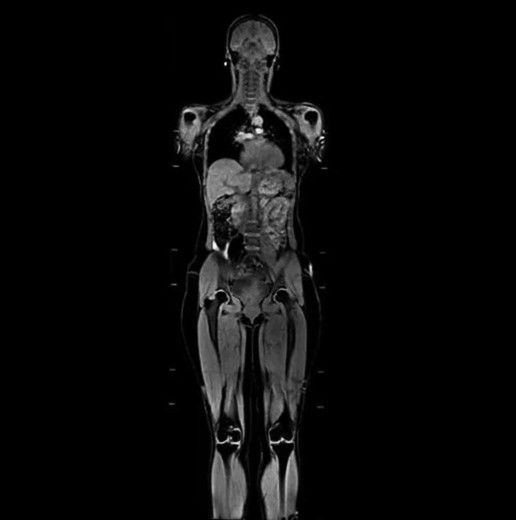 body-ff-desktop