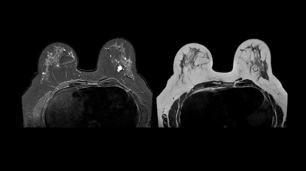 <p>Cube (compatible with AIR™ Recon DL) &amp; Cube Flex</p>
