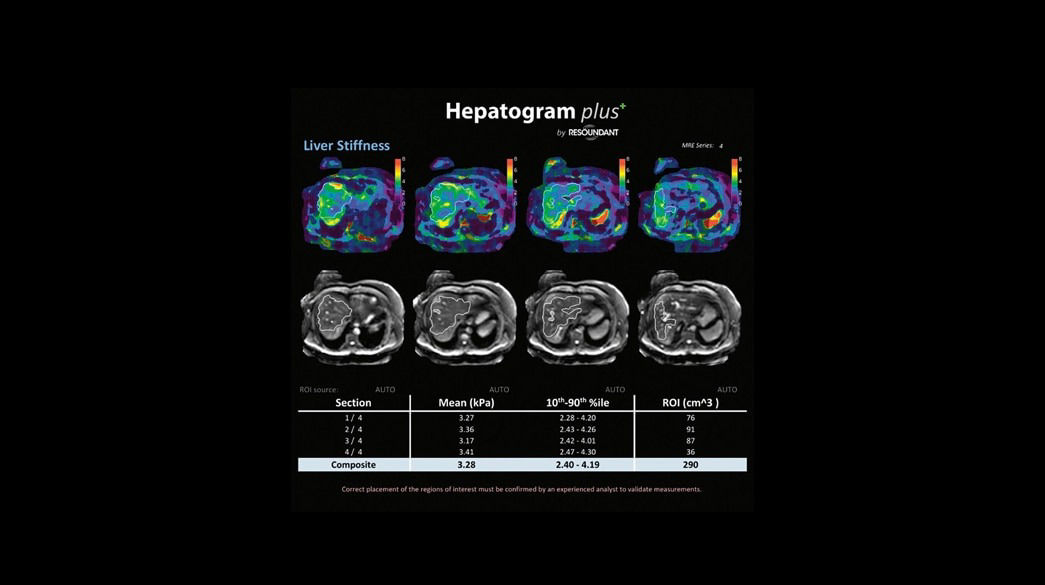<p>Hepatogram plus+</p>
