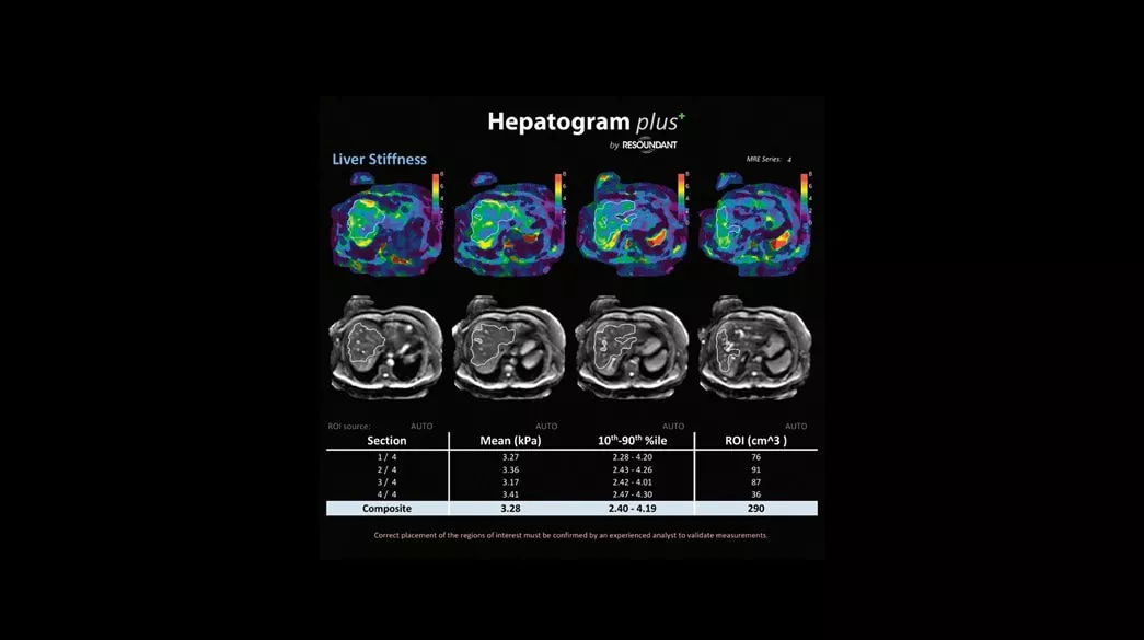 <p>Hepatogram plus+</p>
