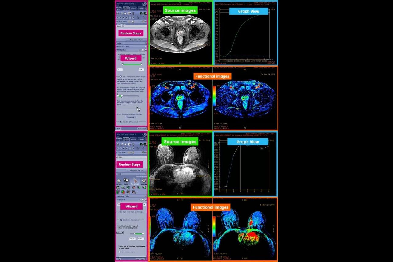 bodyview-custom-workflow-ci-en