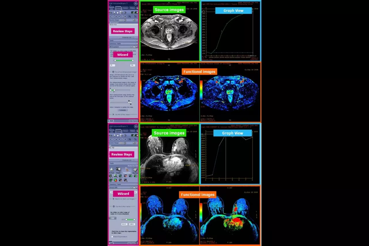 bodyview-custom-workflow-ci-en