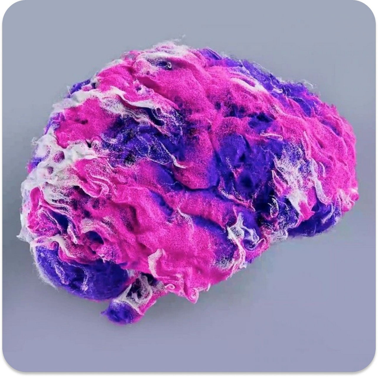 Brain ARDL copy