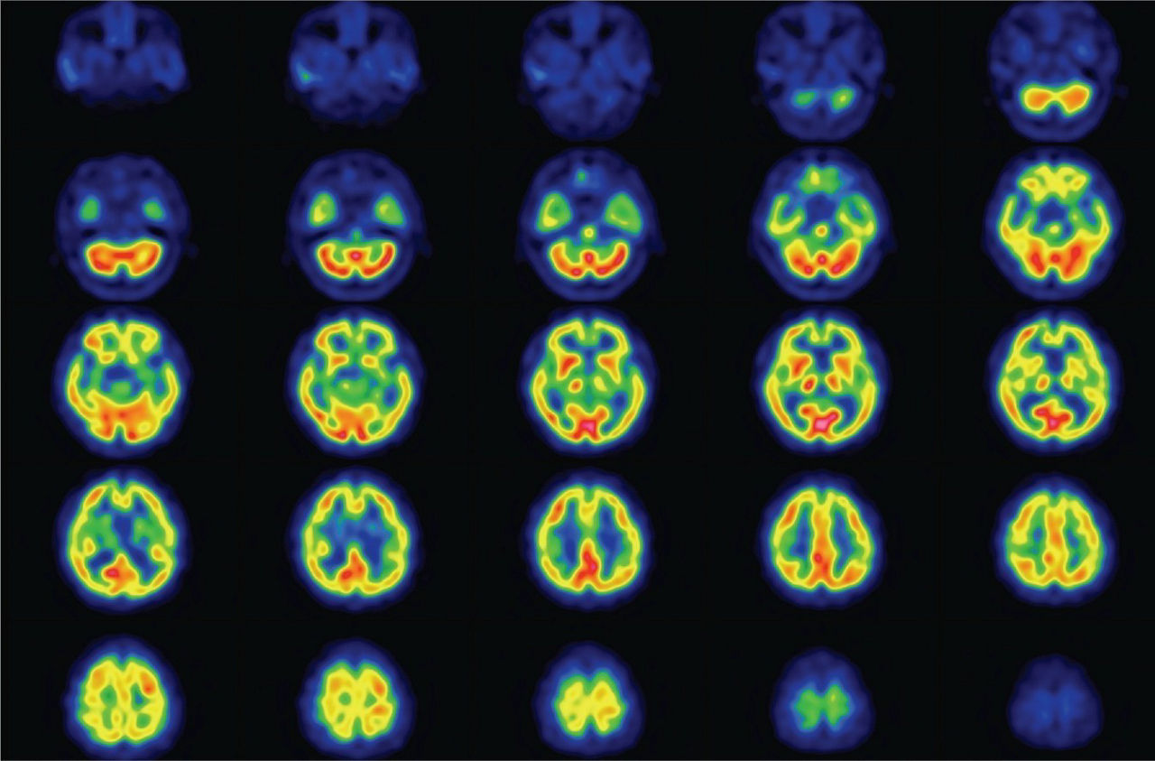 Brain_Scan