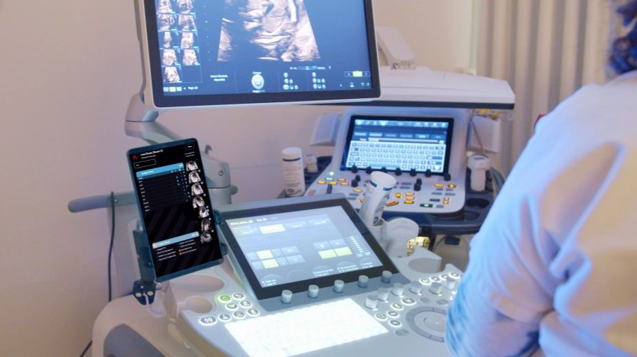 brightheart-for-voluson-about-ba-en