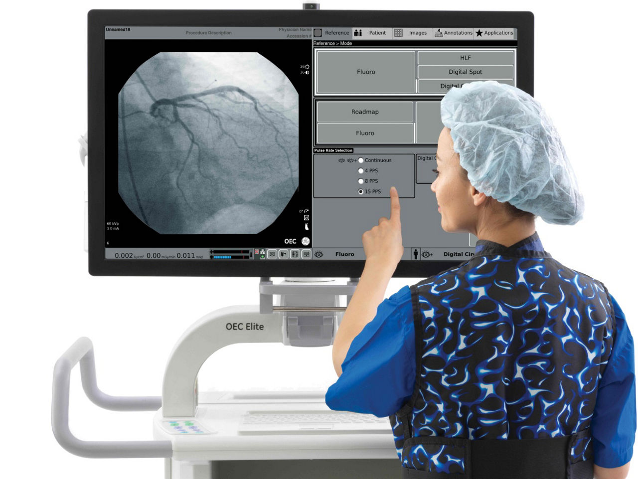 c-arms-for-cardiac-clear