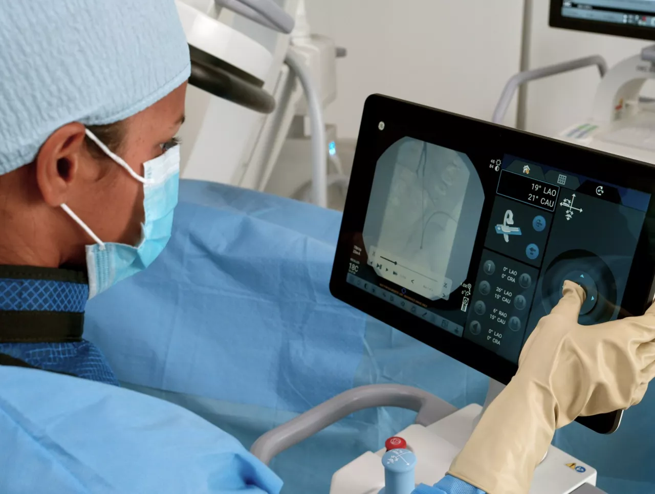 c-arms-for-cardiac-precise-s-curve-st-en
